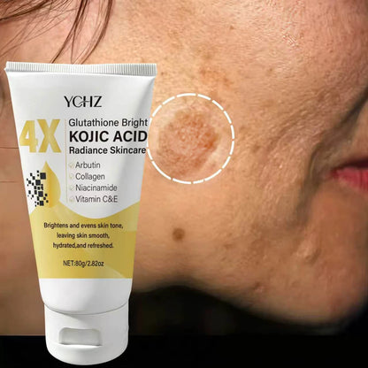Kojic Acid Face Cream – Brightens Skin Tone, Helps Reduce Dark Spots & Hydrates | Lightweight Day & Night Moisturizer for Women & Men